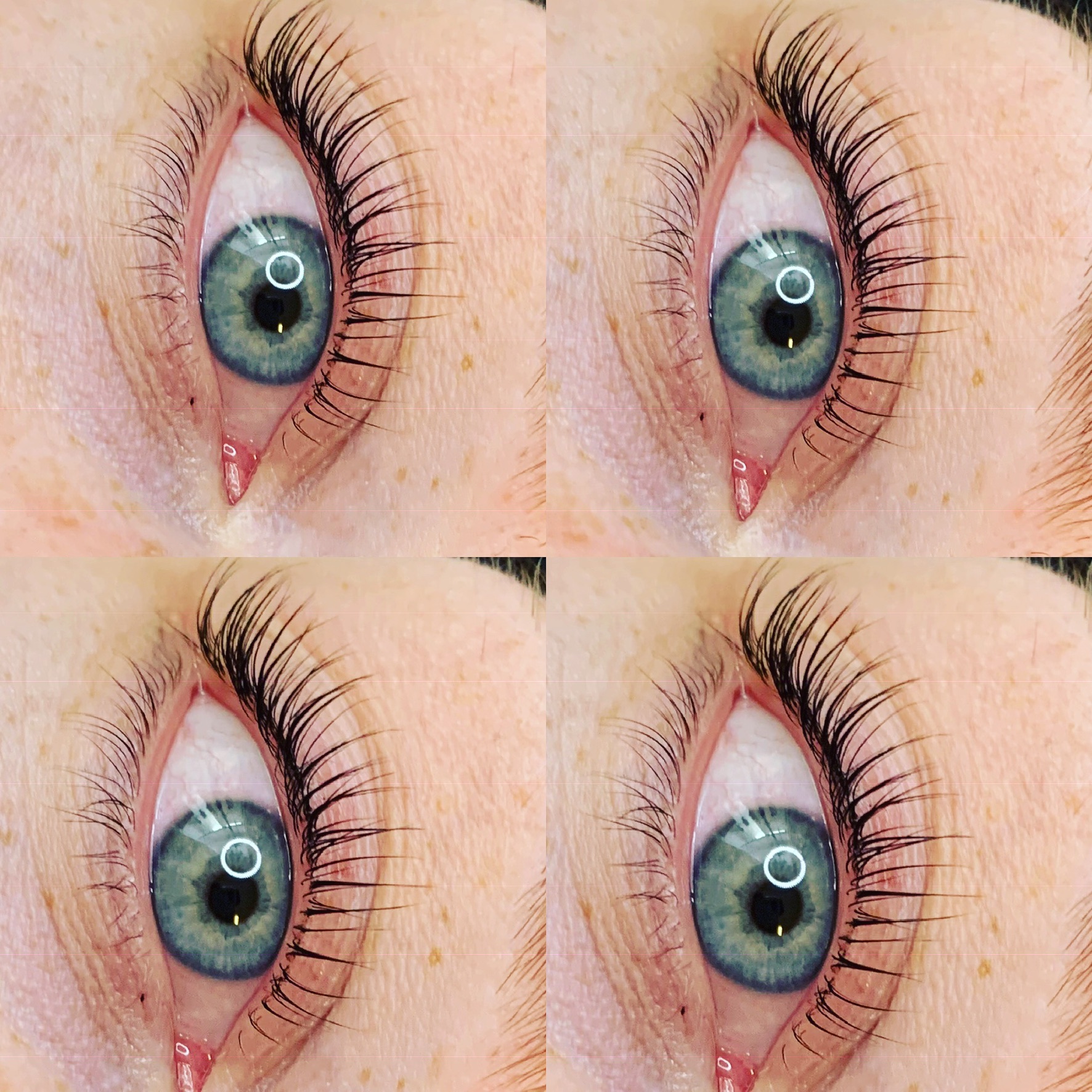 Augen